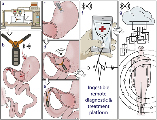 3D‐printed gastric resident electronics (GRE) for biomedical applications. Illustration describes the 3D‐printed GRE concept: A) patient‐specific multimaterial 3D printing of GRE. B) GRE is designed to be delivered orally (1), reside in the stomach for weeks (2), and finally break up (3) pass through the pylorus and be excreted from the gastric space. C) Specifically, the GRE can be compressed into a capsule‐size dosage form. D) The expansion of the device enables gastric residence and allows long‐term remote communication with personal device. E) Ultimately, the disintegration of the device allows the safe passage of the device from the gastric space. F) GRE is directly compatible with personal devices, such as a smart phone, empowering the users to communicate and control the long‐residence device without a specialized equipment. G) This enables a seamless interconnection with other wireless electronics peripherals, wearable devices, and biomedical implants, allowing a real‐time feedback‐based automated treatment or responsive medication. The interconnection of GRE with the digital cloud via personal electronics could ultimately enable the next generation of digital medical interventions