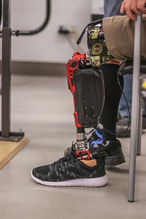 bionic leg 300w